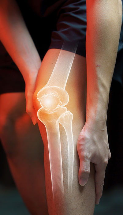 Tenderness of Knee