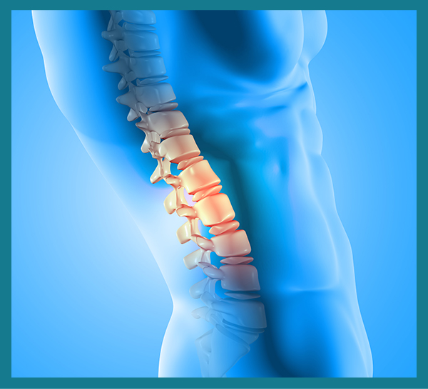 Image of spine