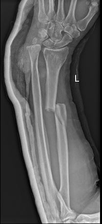 pre operation x ray