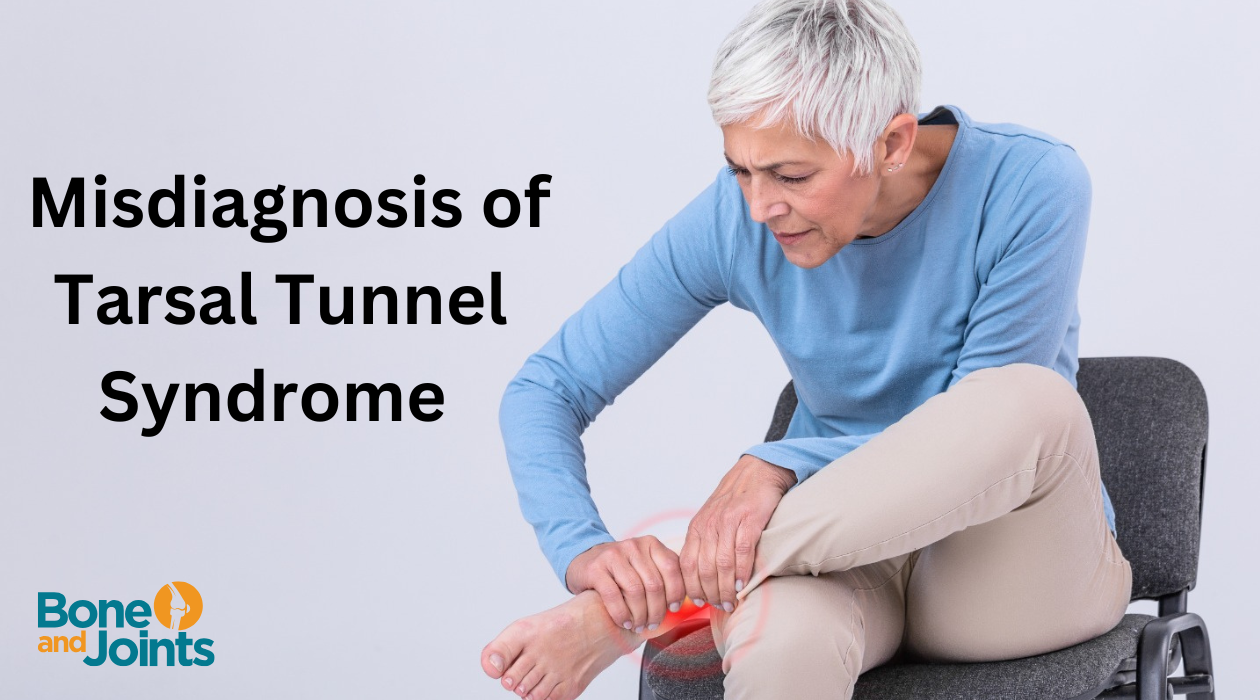 What can be mistaken for tarsal tunnel syndrome?